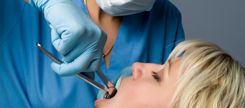 woman-getting-tooth-extraction